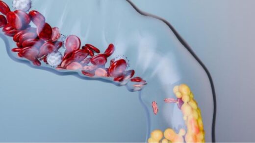 Scientists test peptide vaccine that targets cholesterol-linked protein PCSK9